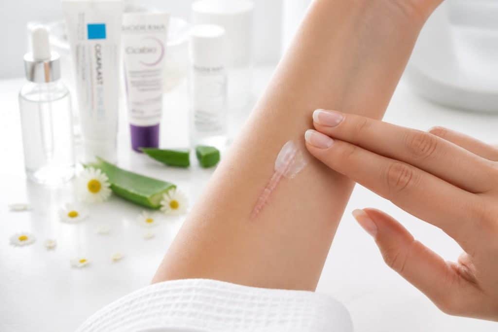 découvrez des méthodes efficaces pour effacer une cicatrice et retrouver une peau nette. conseils, traitements et astuces pour améliorer l'apparence de votre peau.